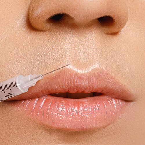 ostia-dental-clinic-anti-aging-filler-treatment-lips-volume-sessions