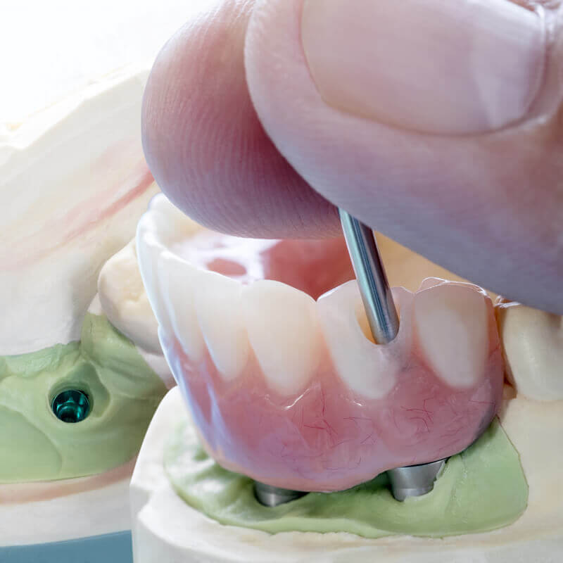 ostia-family-dental-clinic-orthodontics-toronto-bridge