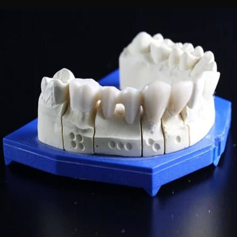 studio-dentista-lido-di-ostia-trattamenti-terapie-new-protesi-fissa-topblock-800